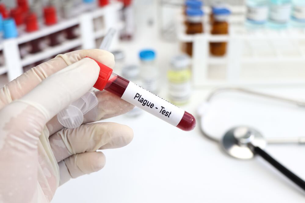 Tercer caso de peste bubónica en EU en 2024: Colorado confirma contagio humano. Foto iStock / Kittisak Kaewchalun