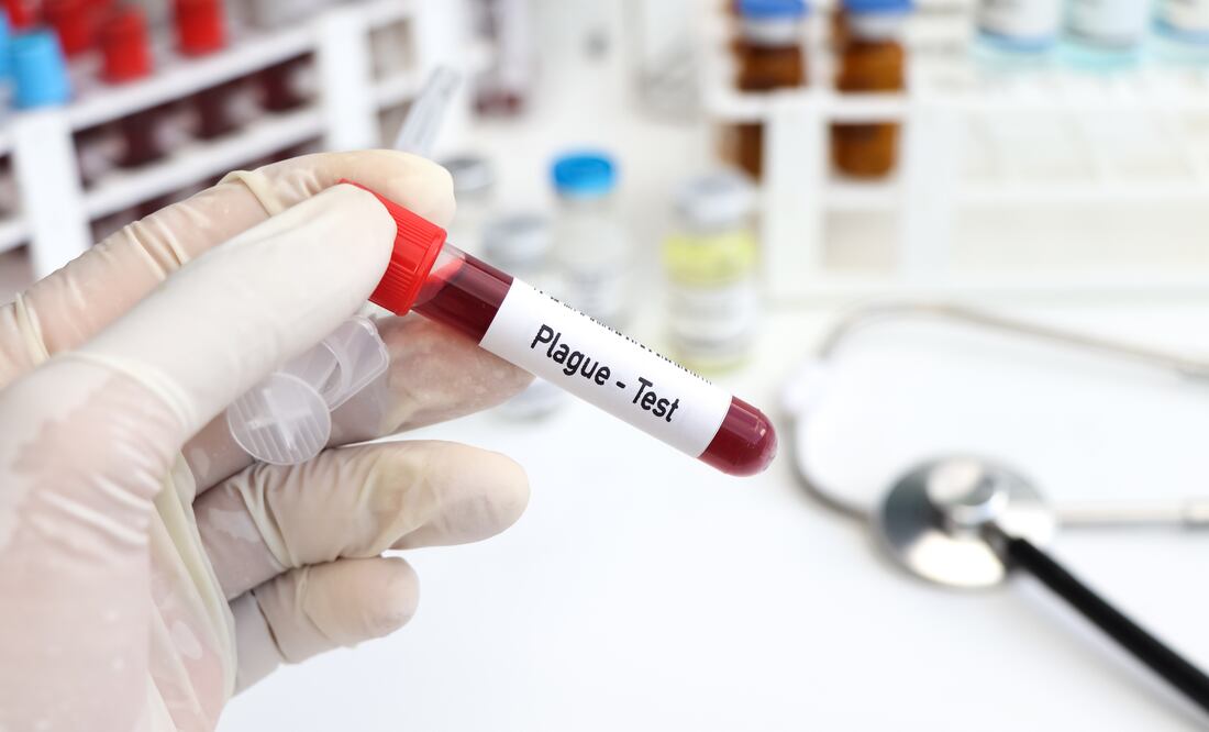 Tercer caso de peste bubónica en EU en 2024: Colorado confirma contagio humano. Foto iStock / Kittisak Kaewchalun