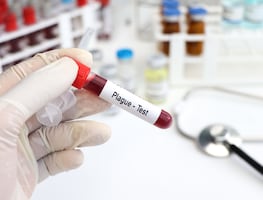 Tercer caso de peste bubónica en EU en 2024: Colorado confirma contagio humano. ¿Qué es y cómo se contagia?