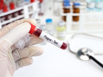 Tercer caso de peste bubónica en EU en 2024: Colorado confirma contagio humano. ¿Qué es y cómo se contagia?