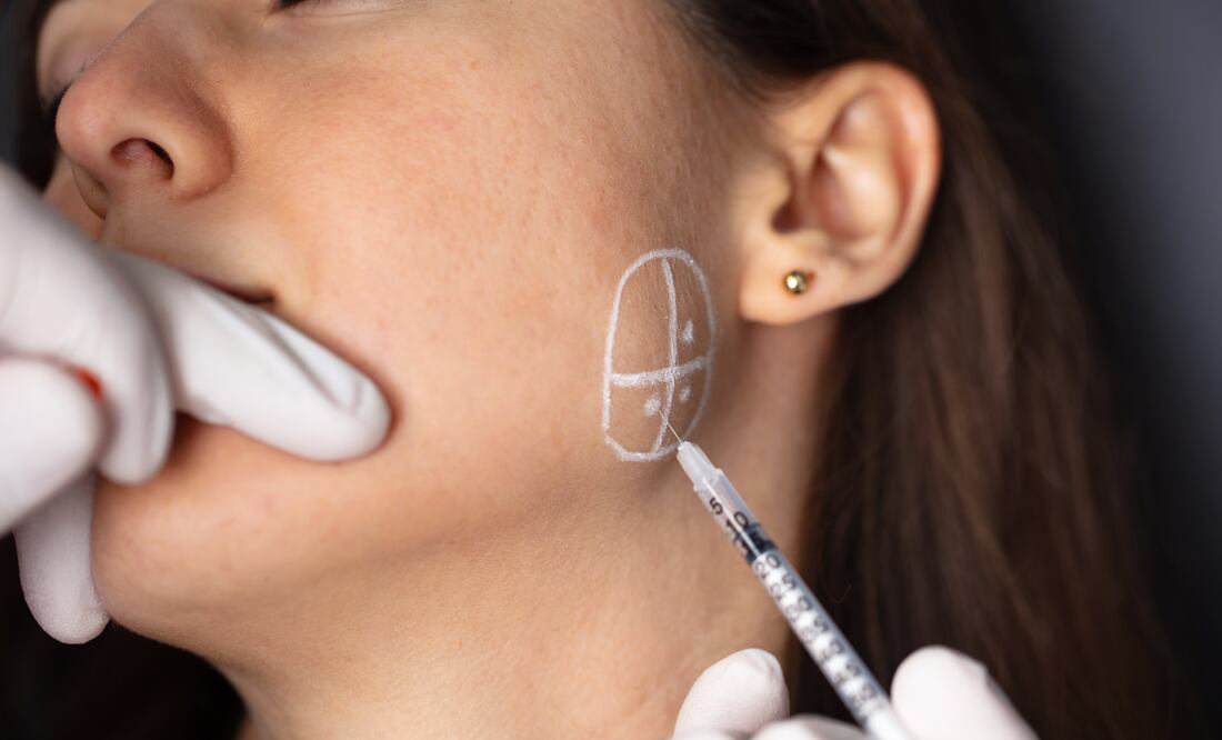 Alerta por inyecciones falsas de bótox: 19 mujeres enfermas en 9 estados de Estados Unidos. Foto iStock Emir Hoyman