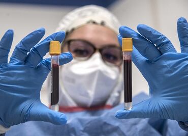 Confirman un caso de gripe aviar en una mujer de 53 años en China