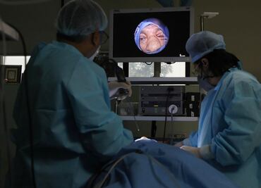 Honduras confirma primer caso de hongo negro en recuperado de covid