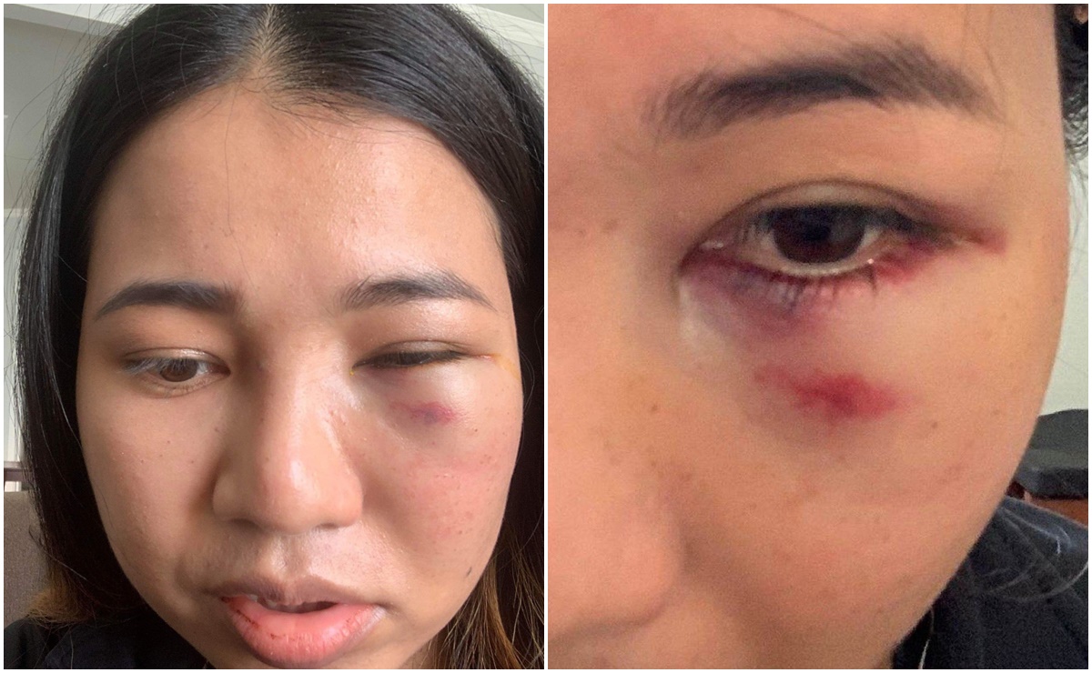 Mujer asi&aacute;tica es brutalmente golpeada en la cara en San Francisco