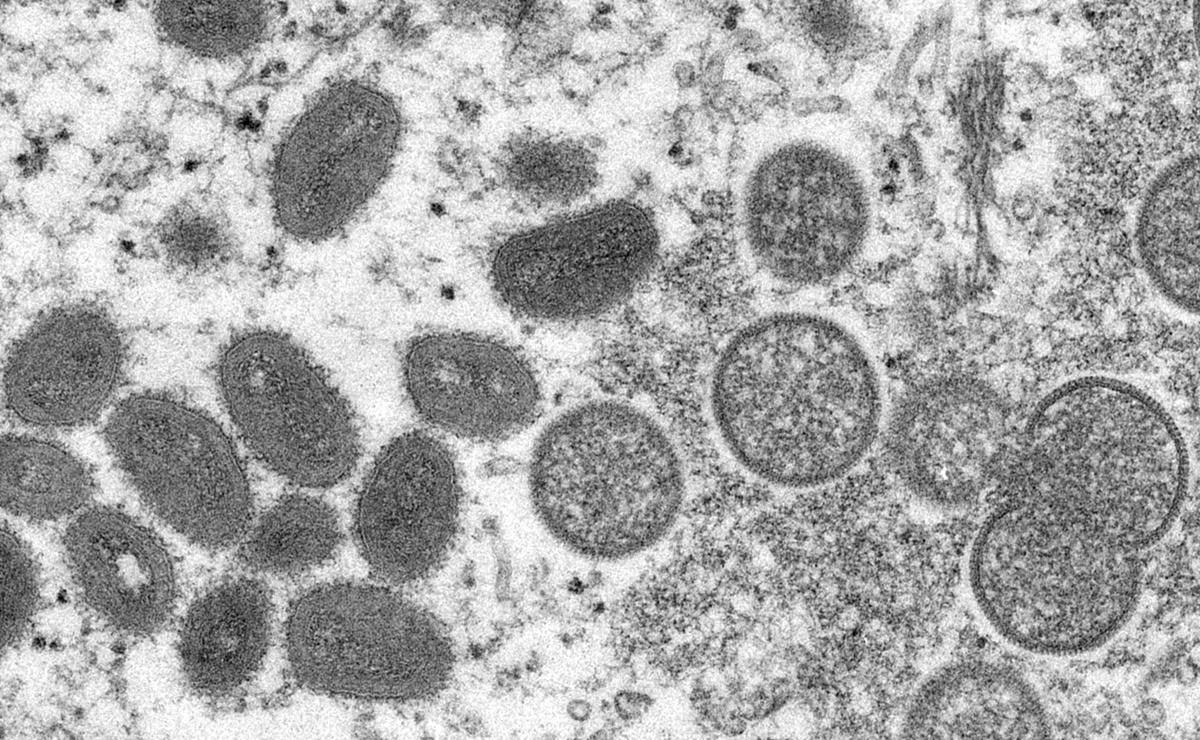 variole du singe.  L’OMS distribuera des vaccins dans plus de 30 pays